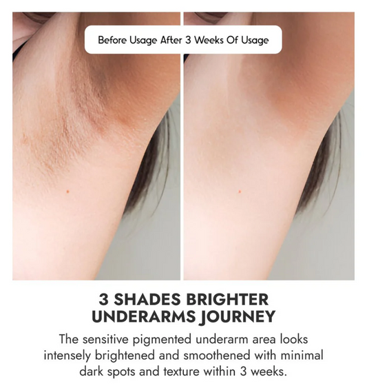 Secret Glow- Underarm Brightening & Smell Control Serum ( BUY 1 GET 1 FREE )