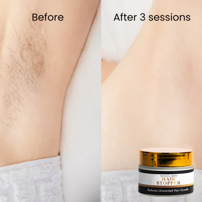 Hair Stopper – Say Goodbye to Unwanted Hair Forever